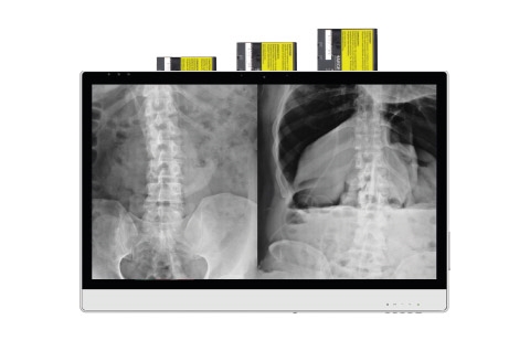 DT-724-medizinischer-Monitor-Akkuzellen-Batterien-antimikrobiell-ST