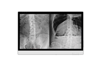 der-mikro-pc-lässt-sich-ausgezeichnet-mit-dem-medizinischen-monitor-dt-724-kombinieren